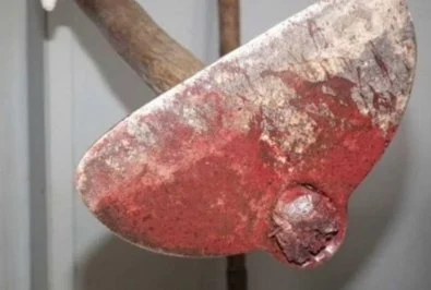 Homem tenta matar irmão com golpe de enxada na cabeça durante briga