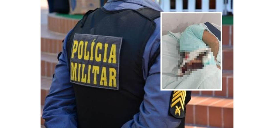 Bandido crava faca nas costas de policial militar e morre baleado