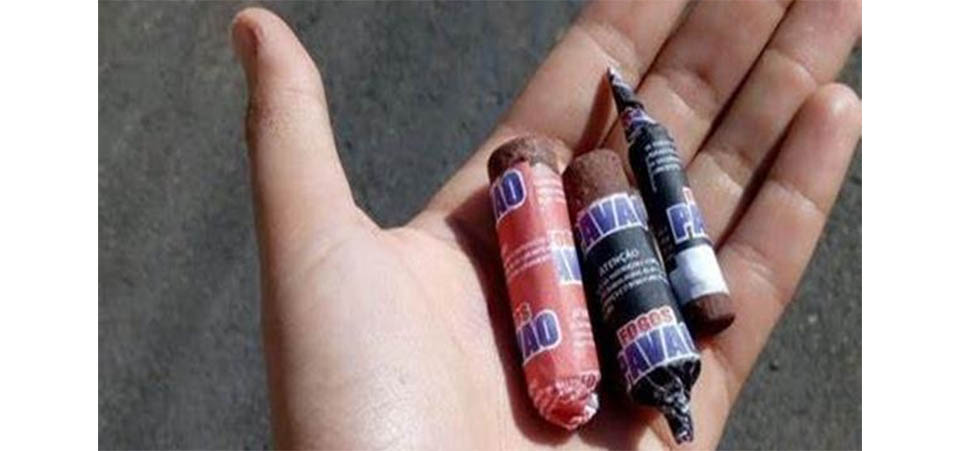 Bombinha explode na mão e menino perde dois dedos