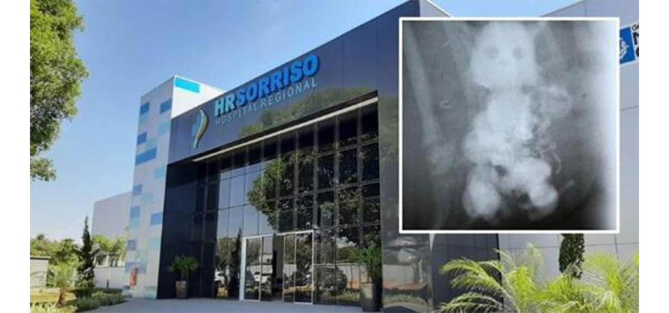 Homem vai parar em hospital após ficar com boneca presa no â…us