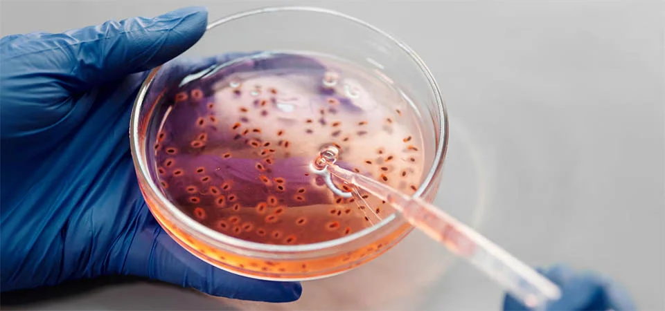 Casos de ‘bactérias do pesadelo’ estão aumentando nos EUA; entenda fenômeno