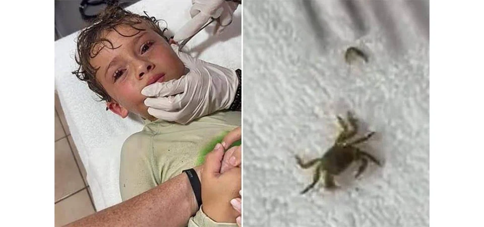 Menino tem caranguejo vivo retirado de ouvido após ida a praia; Veja vídeo