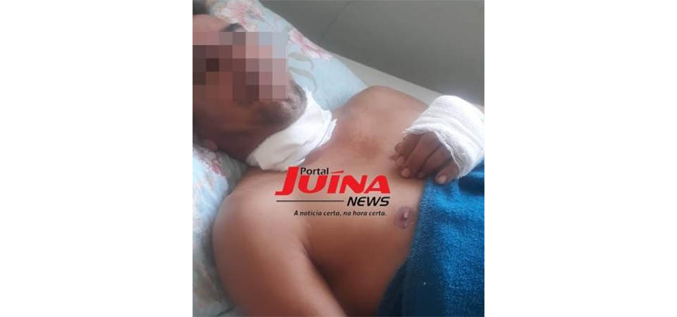 Mulher de 57 anos tem pescoço cortado por linha de pipa com cerol