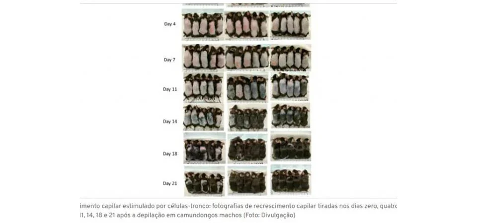 Fim da calvície? Pesquisa com células-tronco consegue regeneração de até 100%