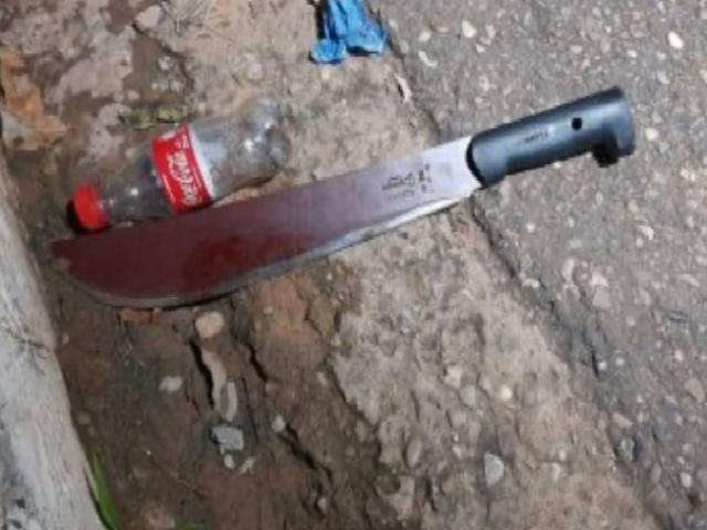 Mulher quase decepa mão do marido após ser espancada