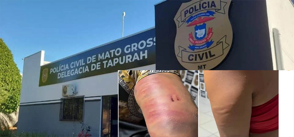 Tapurah: Polícia Civil prende dois homens que deram “salve” em garotas de programa com mangueira