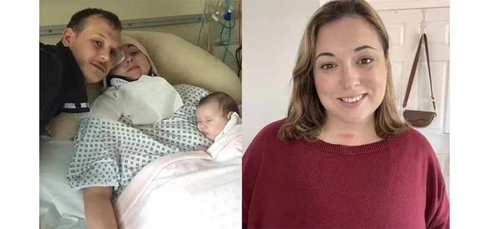 Mulher dá bocejo matinal tão forte que quebra o pescoço