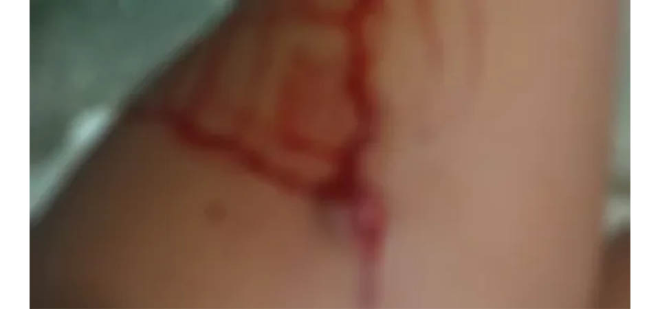 Aluna de 17 anos é esfaqueada durante briga com colega na frente de escola