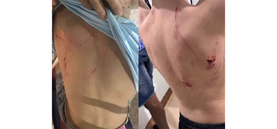 Cão da raça rottweiler é capturado após atacar crianças em praça