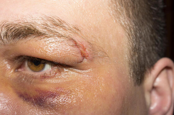 Homem arrasta esposa grávida pelos cabelos e leva surra da sogra