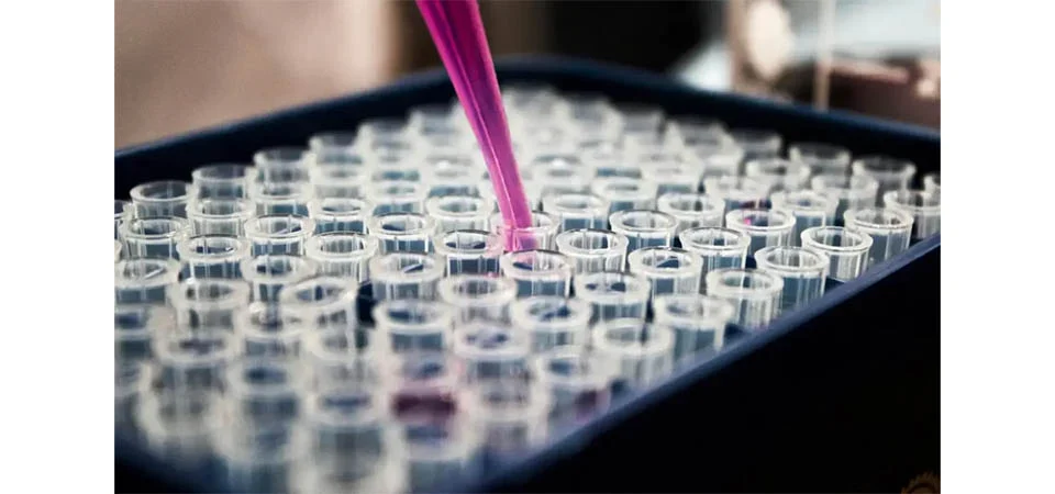 Pesquisas brasileiras avançam no diagnóstico de Alzheimer