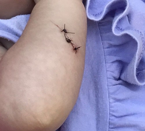 Assaltante esfaqueia bebê de três meses por causa de celular em Bauru