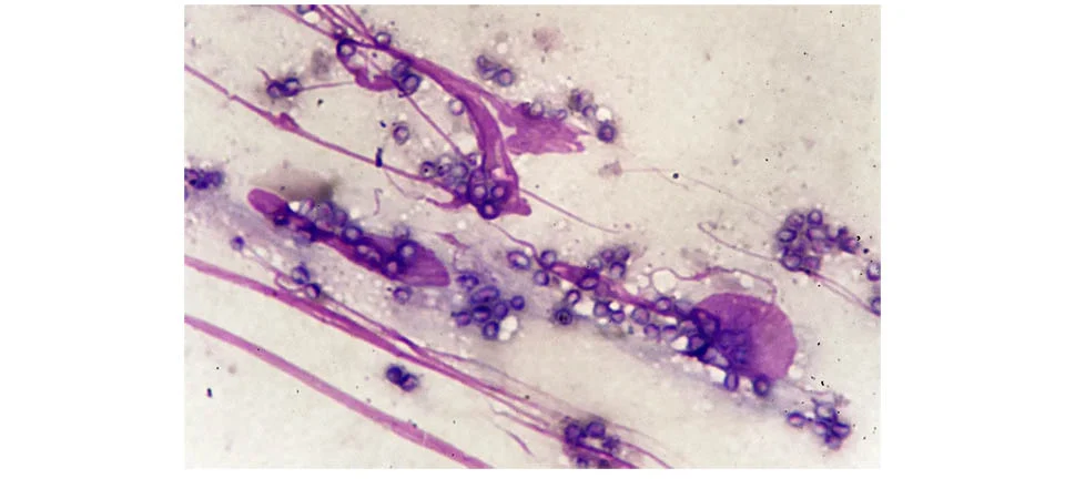 Cogumelos letais: conheça os 5 fungos mais perigosos da natureza