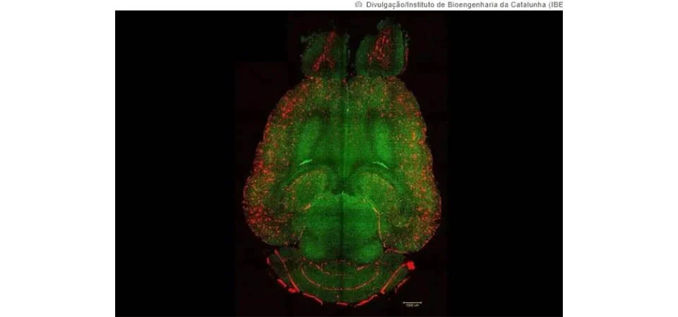 Cientistas revertem Alzheimer em camundongos usando nanopartículas
