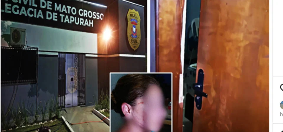 Tapurah: Mulher é agredida pelo marido e tem nariz fraturado