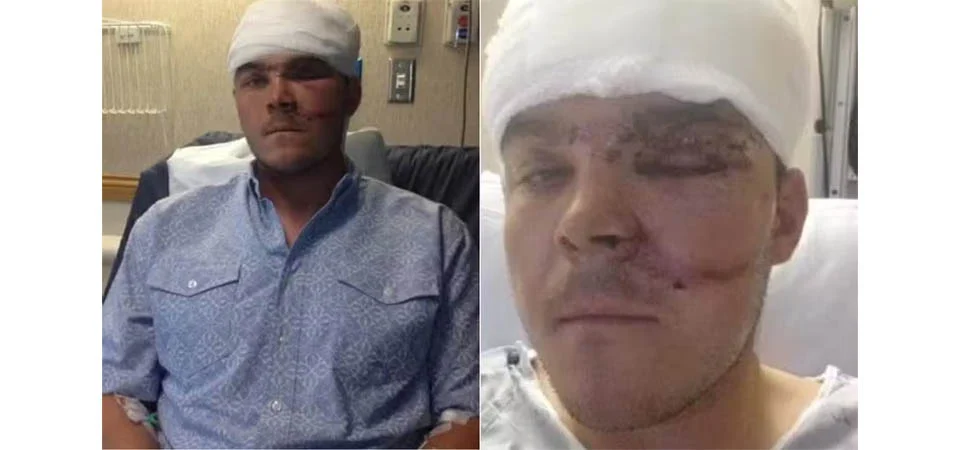 Caçador sobrevive a ataque de urso de 180 kg com manobra inusitada