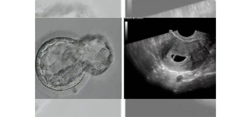 Nasce o primeiro bebê gerado por sistema automatizado de fertilização