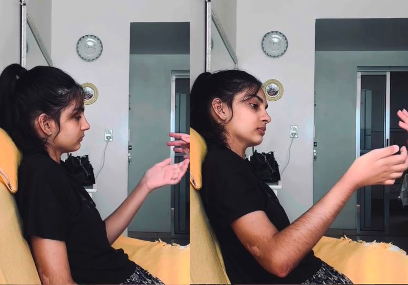 Jovem tetraplégica volta a mexer os braços 5 meses após tratamento com polilaminina