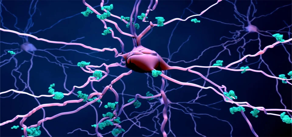 Alzheimer: medicamento pode reduzir morte de neurônios, indica estudo